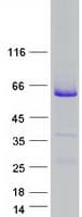 Human RAB3IP / RABIN3 Protein (Recombinant Myc-DDK (Flag))