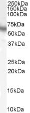 IHC-plus™ Polyclonal Goat anti-Human RPS6KB1 / P70S6K / S6K Antibody (aa490-502, IHC, WB)