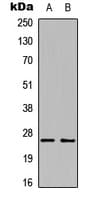 Polyclonal Rabbit anti-Human TNF Alpha Antibody (Internal, WB)