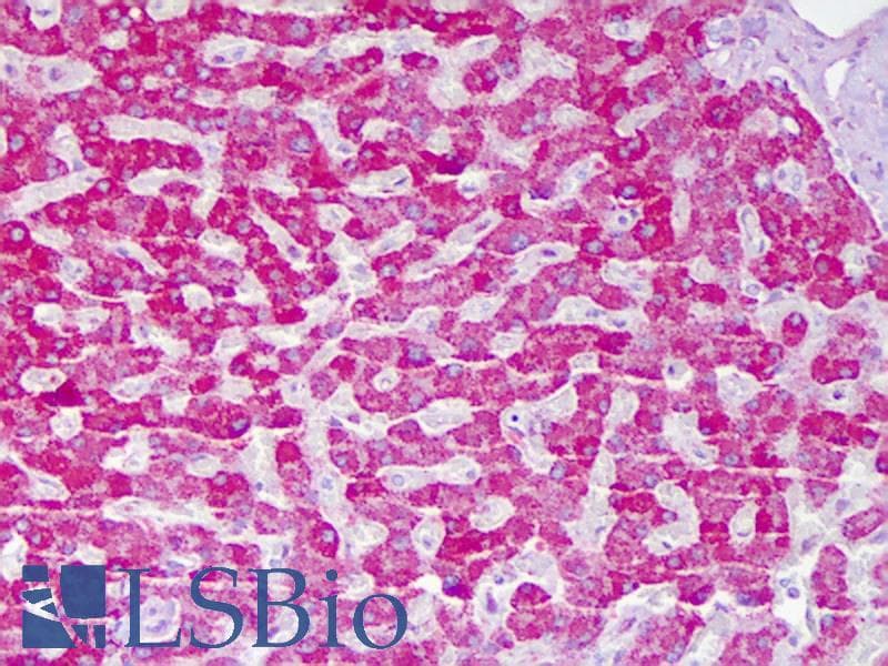 IHC-plus™ ACAT1 Antibody (aa221-270)