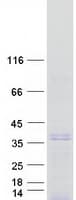 Human SIX2 Protein (Recombinant Myc-DDK (Flag))