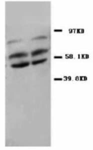 PP2Ac / PPP2CA Antibody (N-Terminus)