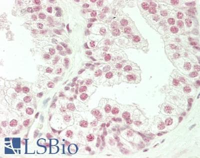 IHC-plus™ ZFP91 Antibody (aa520-570)