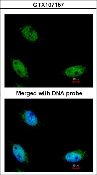 NSUN6 Antibody (aa179-469)