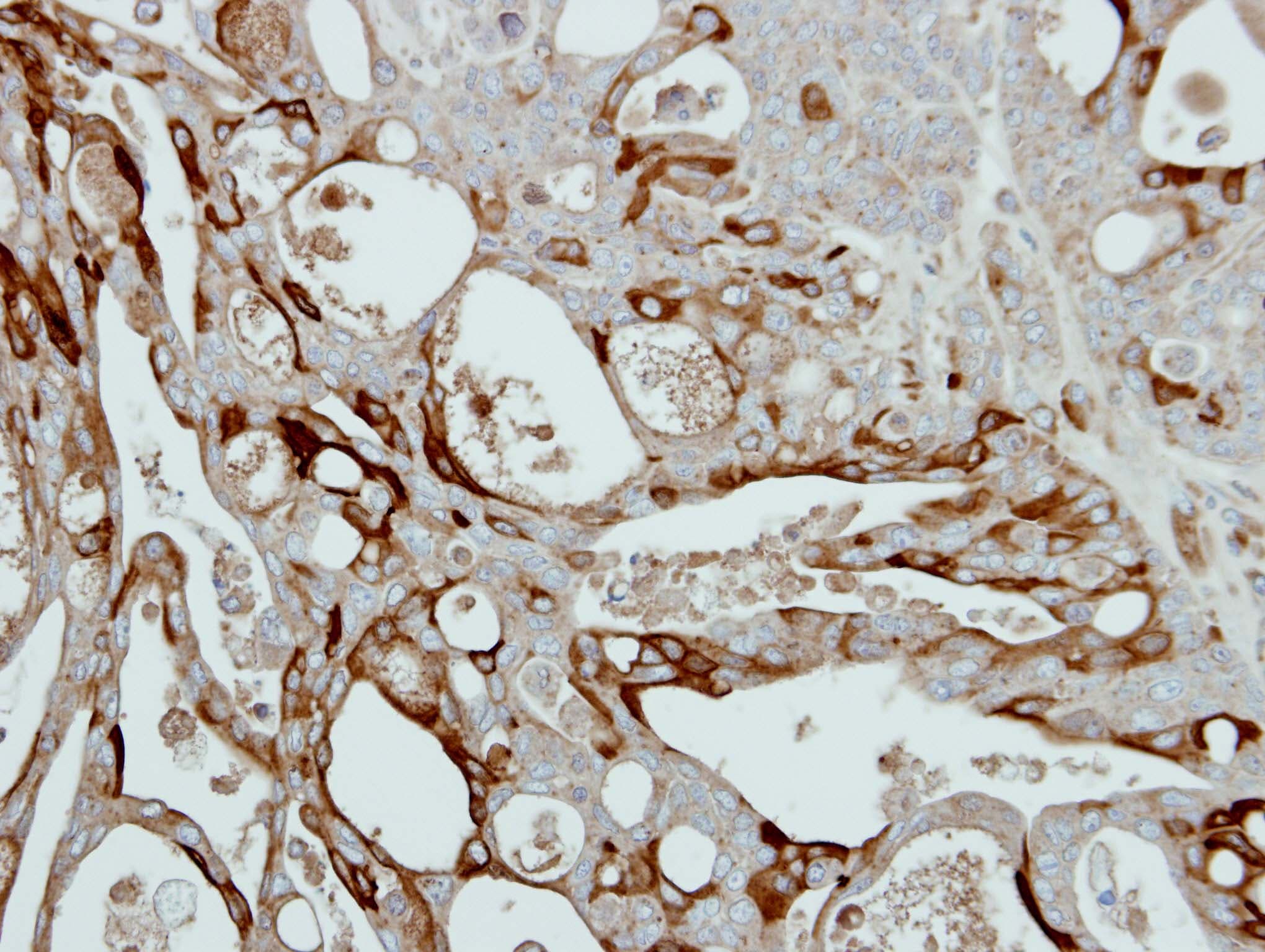 COL3A1 / Collagen III Antibody (aa1247-1389)
