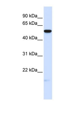 Polyclonal Rabbit anti-Human MFRP Antibody (aa180-229, WB)