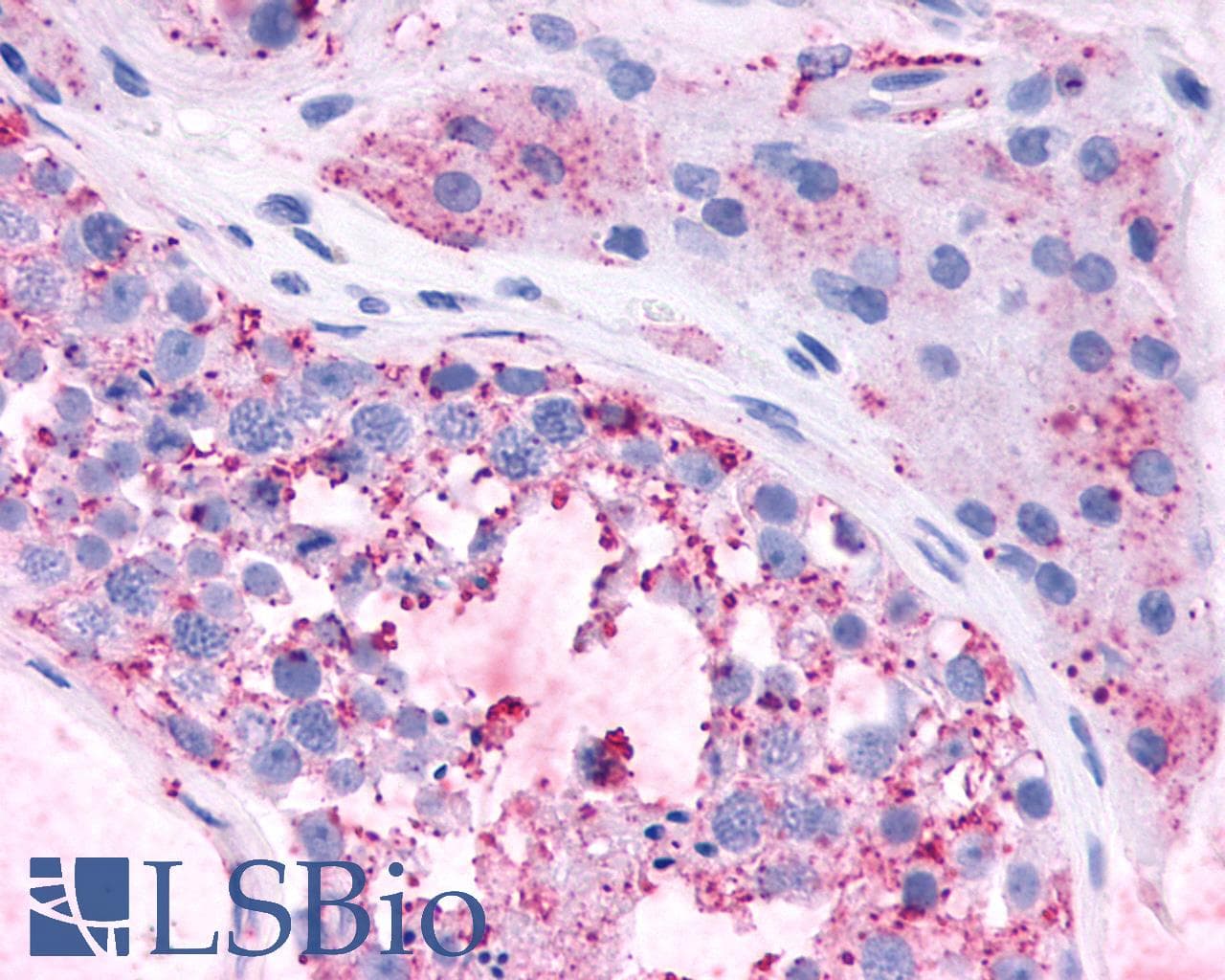 PathPlus™ MAS1 / MAS Antibody (Cytoplasmic Domain)