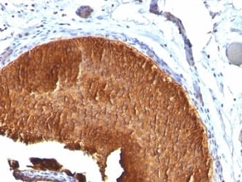 KRT19 / CK19 / Cytokeratin 19 Antibody (clone KRT19/799)