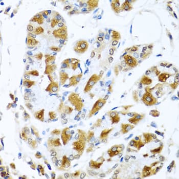 PIAS3 Antibody
