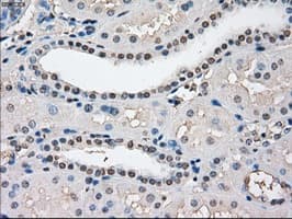 Monoclonal Mouse anti-Human CYPOR / POR Antibody (clone OTI3F10, IHC, IF, WB)