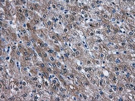 AKT2 Antibody (clone OTI4H7)