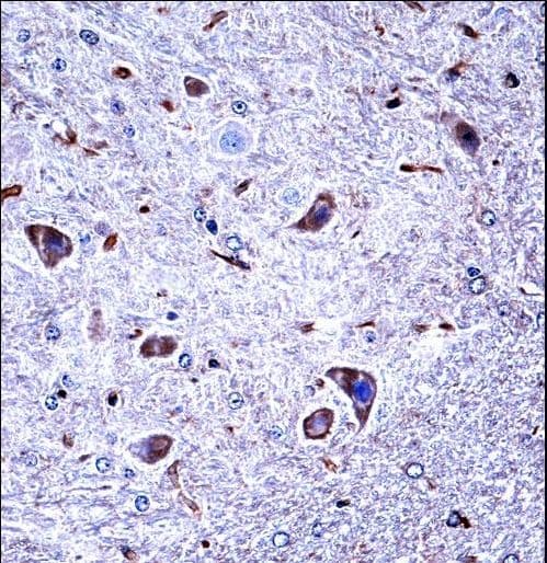 Polyclonal Rabbit anti-Human CSNK1G1 / CKI-Gamma 1 Antibody (aa359-387, IHC, WB)