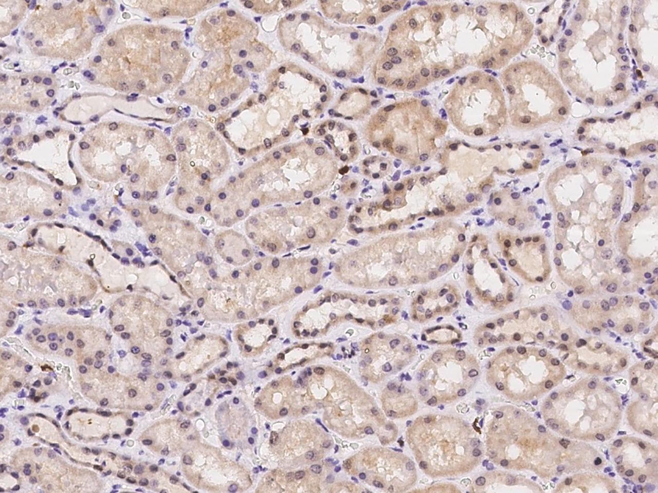 Polyclonal Rabbit anti-Human PRAM1 Antibody (IHC)