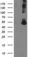 Monoclonal Mouse anti-Human CORO1A / Coronin 1a Antibody (clone OTI1A5, IF, WB)