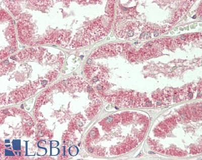 IHC-plus™ TRAPPC9 Antibody (aa282-299)