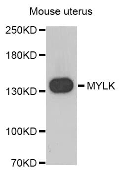 IHC-plus™ MYLK Antibody