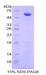 Human ADIPOR2 Protein (Recombinant His-GST)