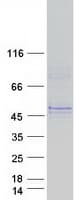 Human GLT8D2 Protein (Recombinant Myc-DDK (Flag))