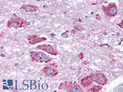 PathPlus™ Polyclonal Rabbit anti-Human NPY4R / PPYR1 Antibody (C-Terminus, IHC)