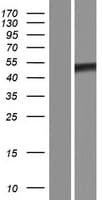 TRIOBP Protein (Over-Expression Lysate Myc-DDK (Flag))