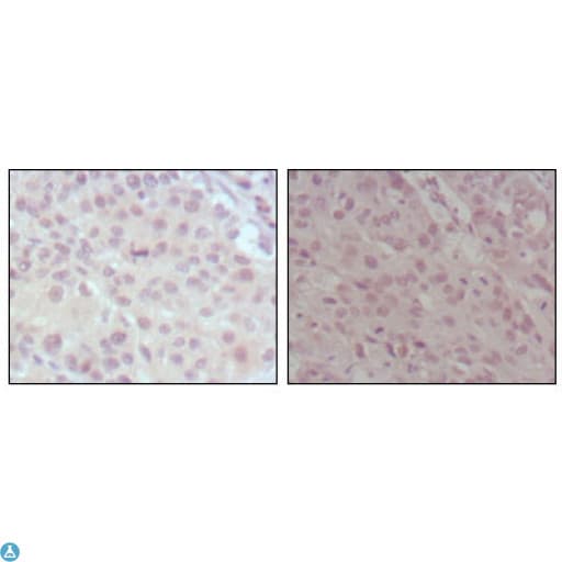 Monoclonal Mouse anti-Human KMT2A / MLL Antibody (IHC, WB)