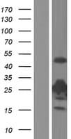 TK1 / TK / Thymidine Kinase Protein (Over-Expression Lysate Myc-DDK (Flag))