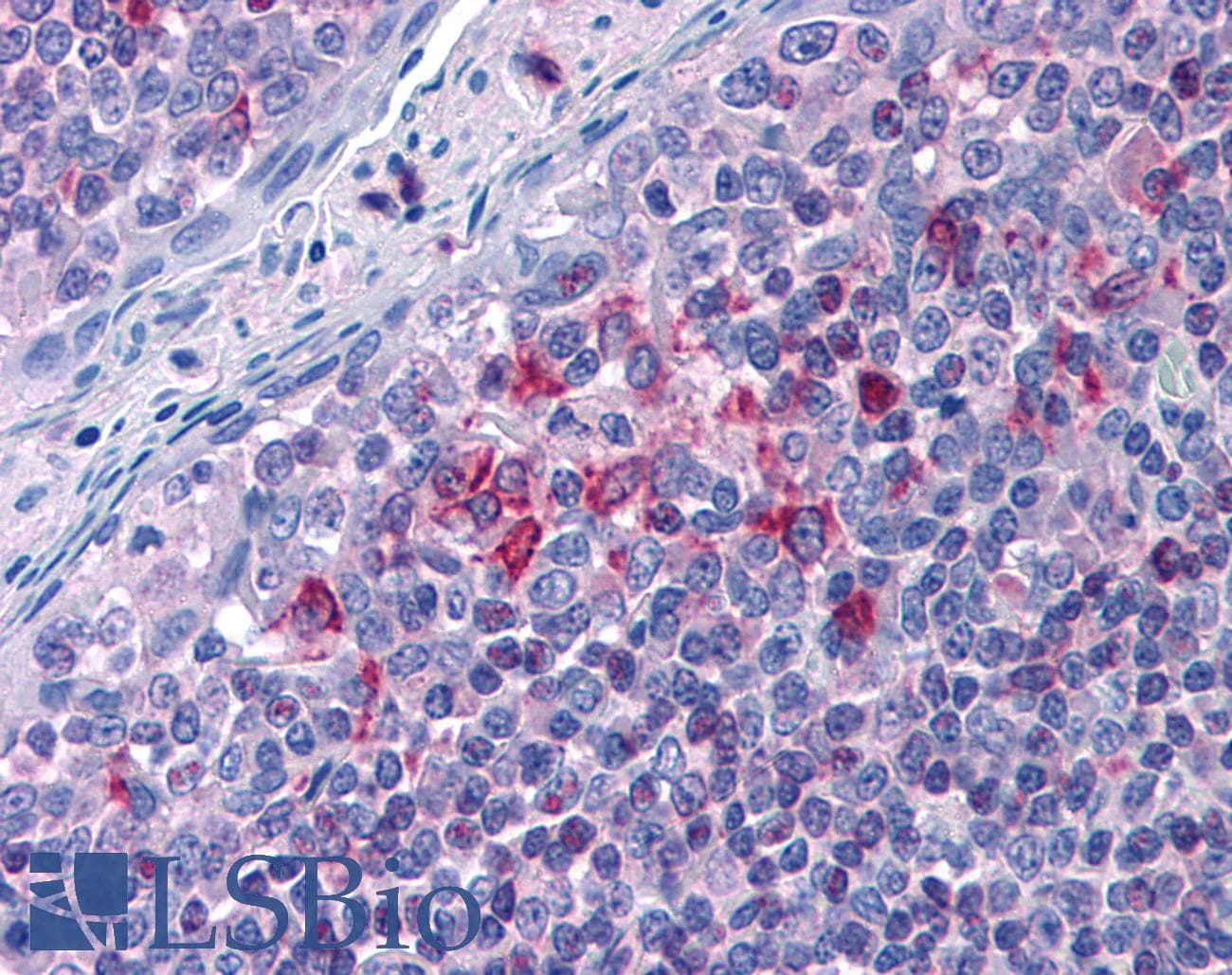 IHC-plus™ ALOX5AP / FLAP Antibody (aa148-161)