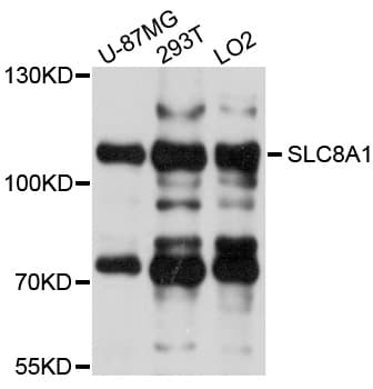 IHC-plus™ SLC8A1 / NCX1 Antibody