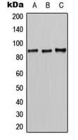Polyclonal Rabbit anti-Human CLC-7 / CLCN7 Antibody (N-Terminus, IF, WB)