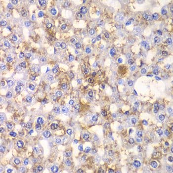 Polyclonal Rabbit anti-Human HAPLN1 Antibody (IHC, WB)