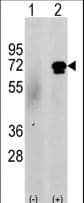 CAMKK2 Antibody (aa52-82)