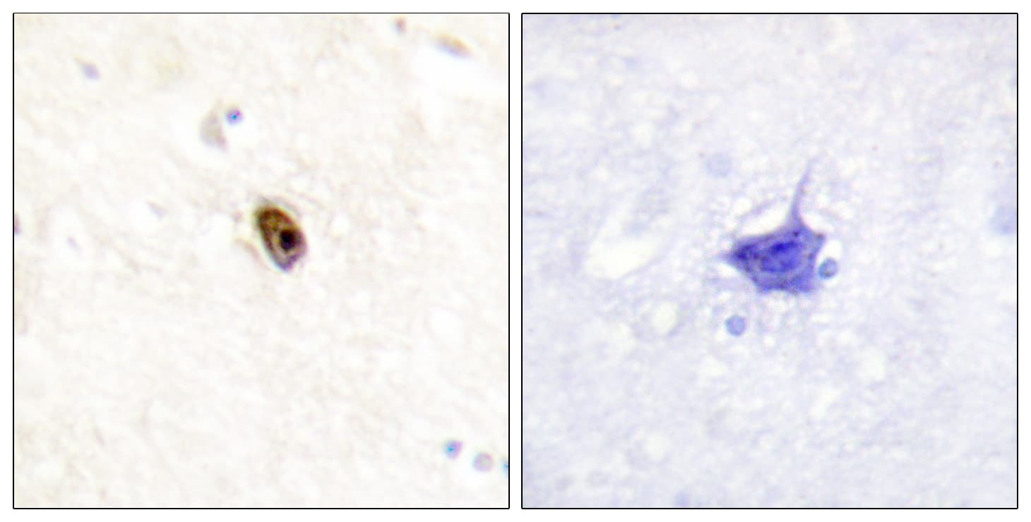 Polyclonal Rabbit anti-Human Aurora Kinase B+C Antibody (phospho-Thr236/Thr202, IHC)