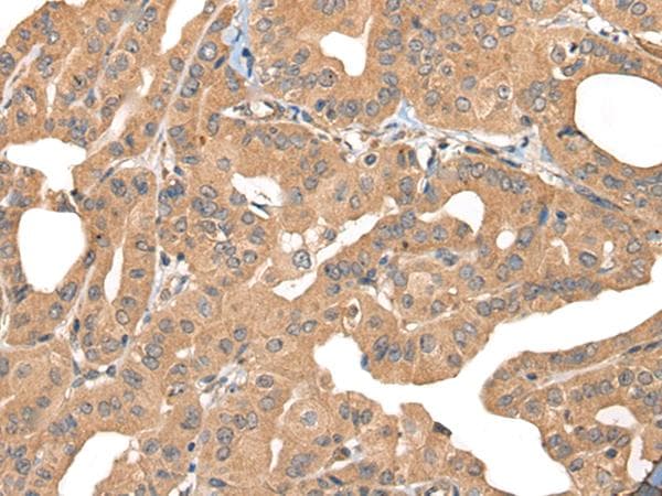 PPP3R1 / Calcineurin B Antibody