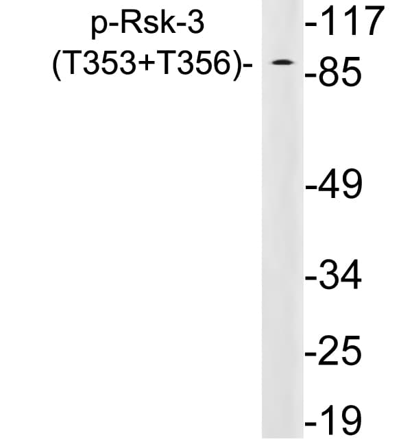 Polyclonal Rabbit anti-Human RPS6KA2 / RSK3 Antibody (phospho-Thr353, WB)