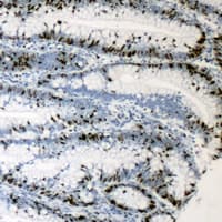 NIFK / MKI67IP Antibody (Internal)