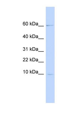 Polyclonal Rabbit anti-Human PI3 / Elafin Antibody (aa36-85, WB)