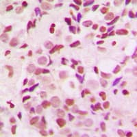 Polyclonal Rabbit anti-Human SDCCAG1 / NEMF Antibody (C-Terminus, IHC, WB)