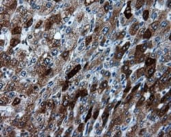 TPMT Antibody (clone OTI2A2)