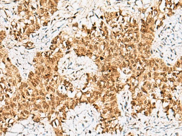 CRCP / CGRP Receptor Component Antibody