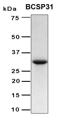 Brucella abortus 31 kDa immunogenic protein (Recombinant 6His, N-terminus)