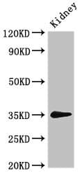 Polyclonal Rabbit anti-Human PRPS2 Antibody (IHC, IF, WB)