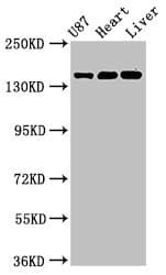GRIN2A / NMDAR2A / NR2A Antibody (aa501-750)
