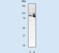 PRKCA / PKC-Alpha Antibody (phospho-Thr638, clone E195)