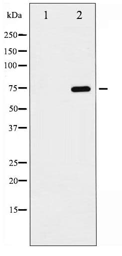 RELA / NFKB p65 Antibody (phospho-Ser468)
