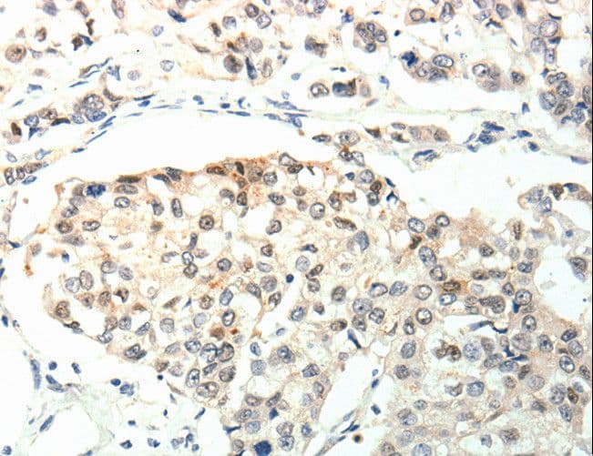 TPM2 Antibody