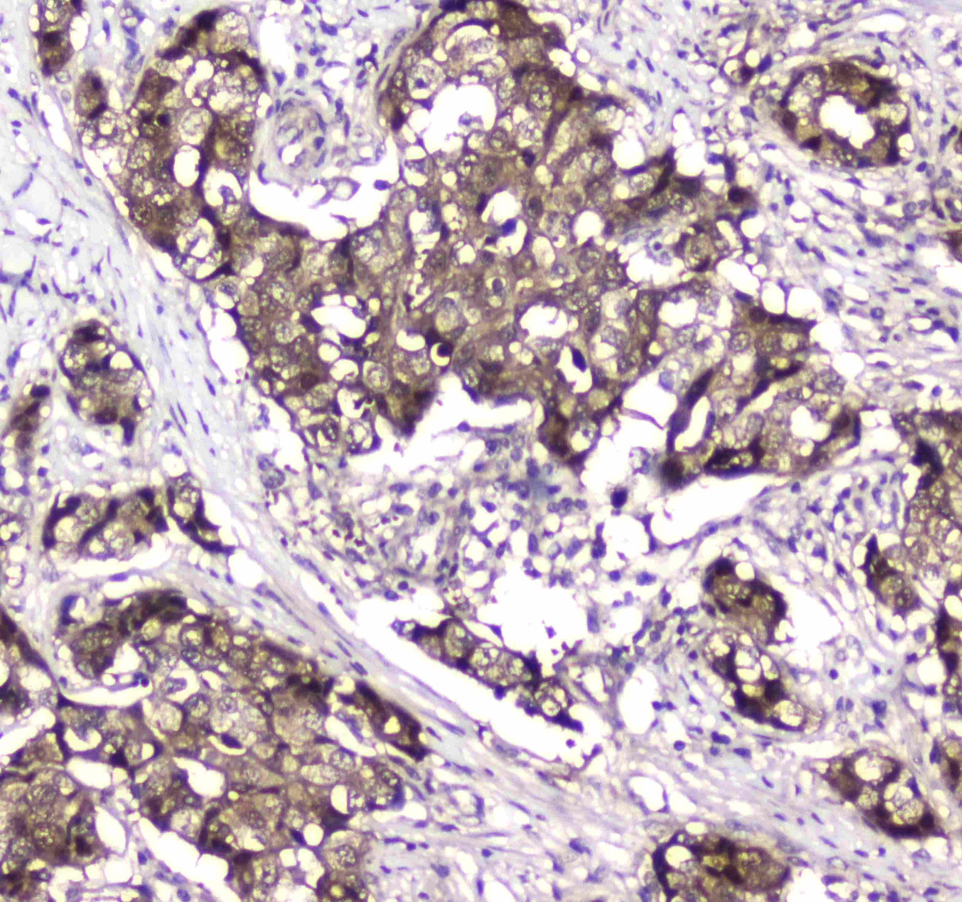 Polyclonal Rabbit anti-Human GLO1 / Glyoxalase I Antibody (IHC, WB)