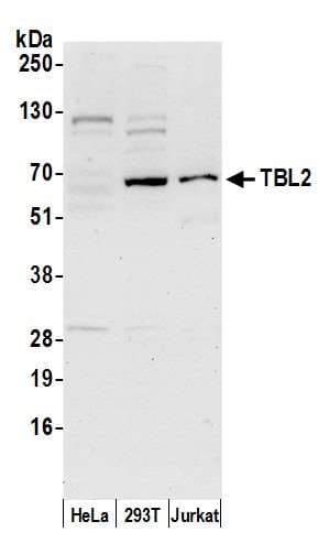 Polyclonal Rabbit anti-Human TBL2 Antibody (aa75-125, WB)
