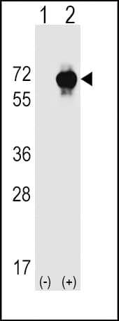 STK39 / SPAK Antibody (aa346-376)
