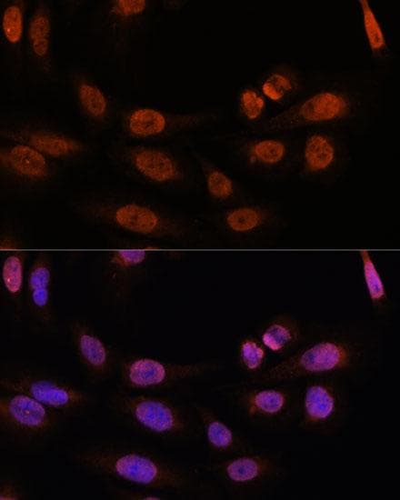 NR1A2 / THRB Antibody