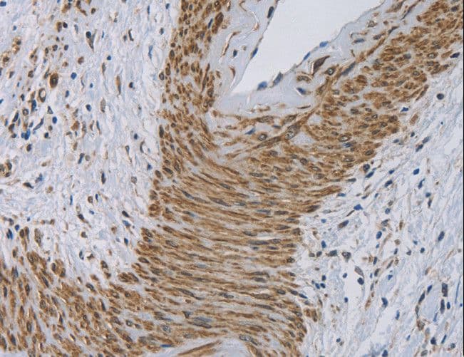 CYB5A / Cytochrome b5 Antibody